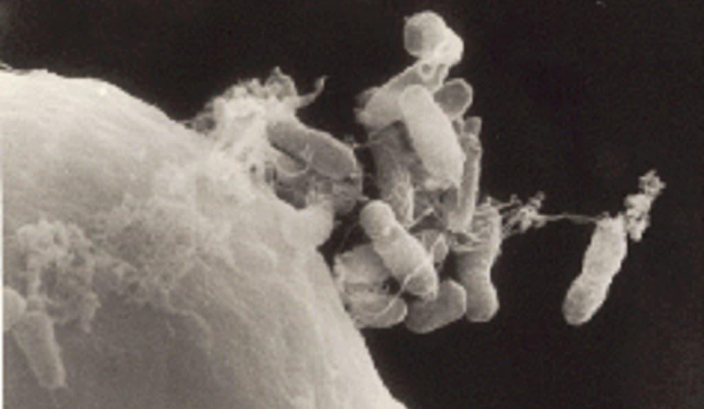 Agrobacterium Tumefaciens Has Been Identified in Morgellons Fibers and Threads