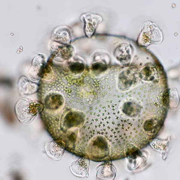 Vorticella (Marine Protozoa) under microscope view.